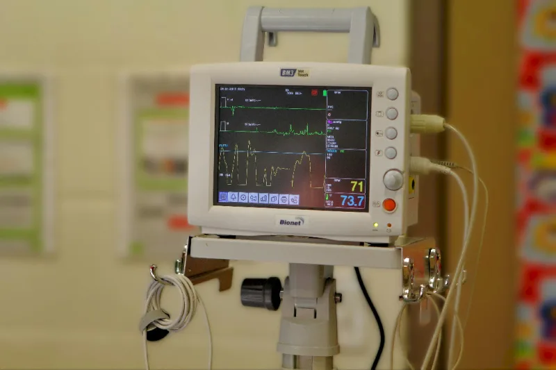 رسم القلب الكهربائي بالكمبيوتر (ECG)