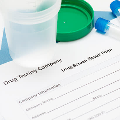 Urine Drug Testing Facts: What You Need to Know