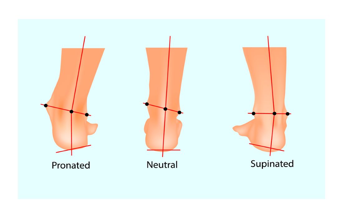 three feet showing pronation neutral and supination