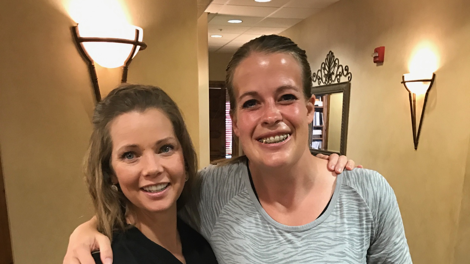 Community facial reconstruction 2015 10