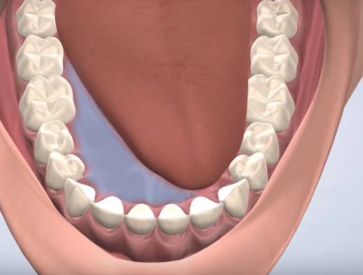 Learn about oral pathology at Columbia Basin Oral & Maxillofacial Surgeons.