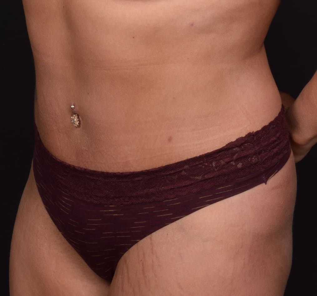 Patient 59 gallery after b