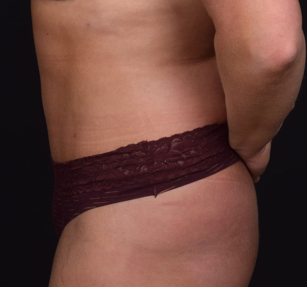 Patient 59 gallery after d