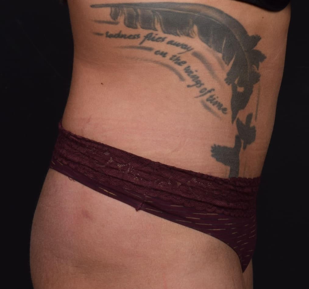 Patient 59 gallery after e