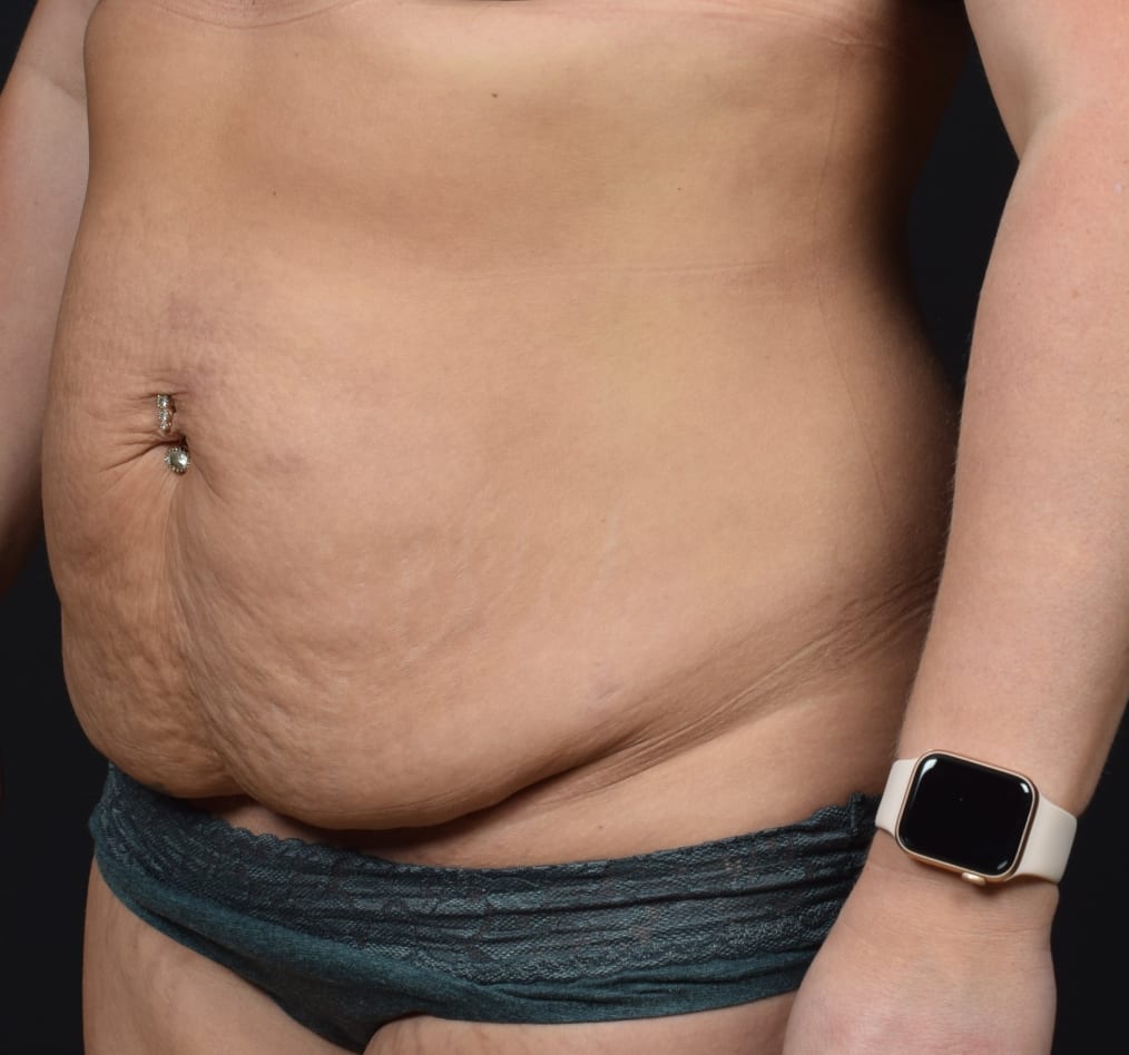 Patient 59 gallery before b