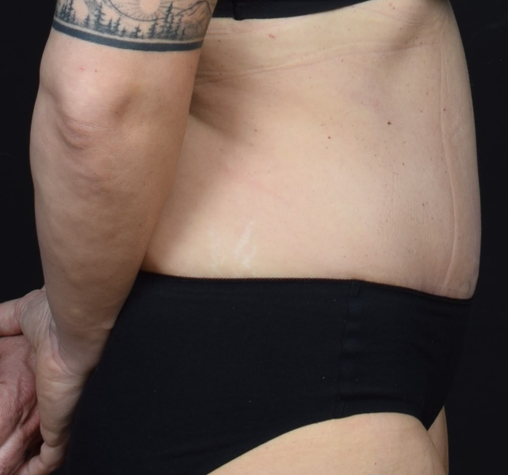 Patient 60 gallery after e