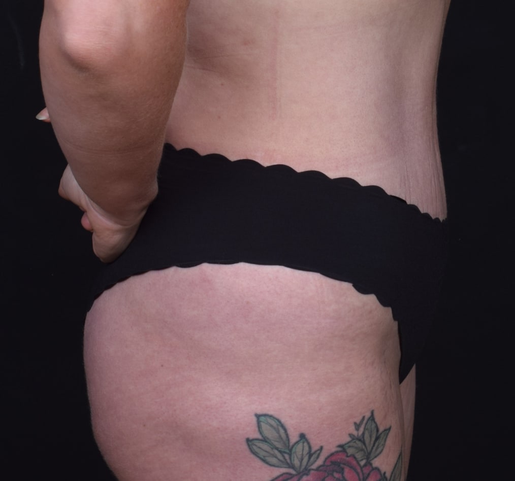 Patient 61 gallery after e