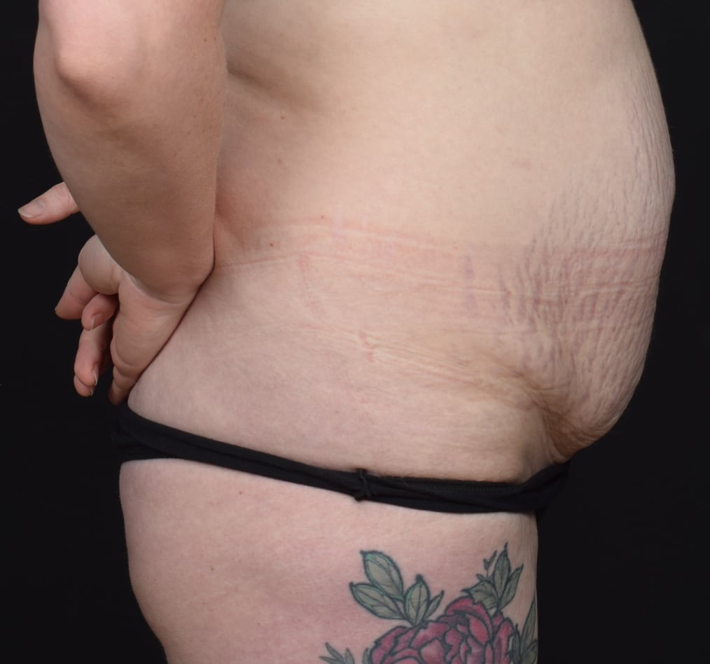 Patient 61 gallery before e