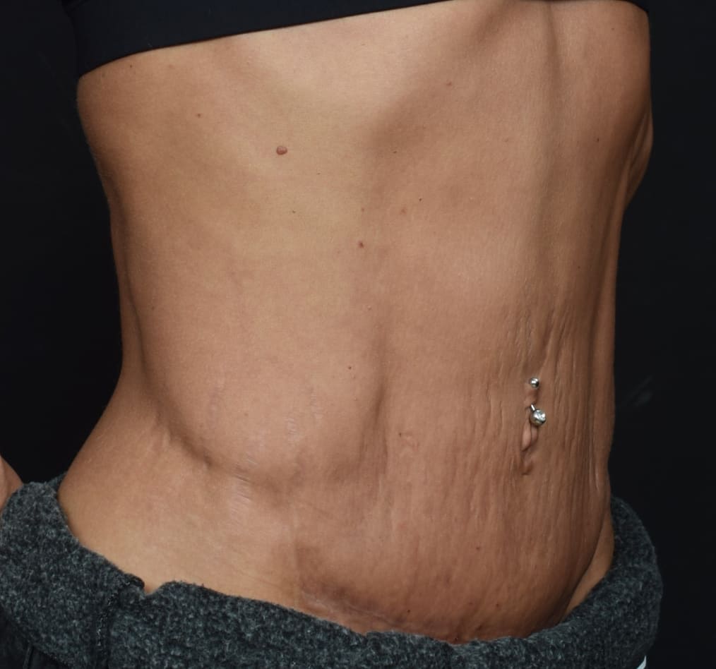 Patient 63 gallery after c