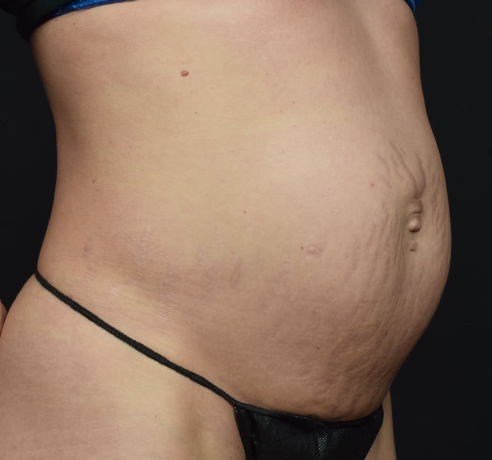 Patient 63 gallery before c