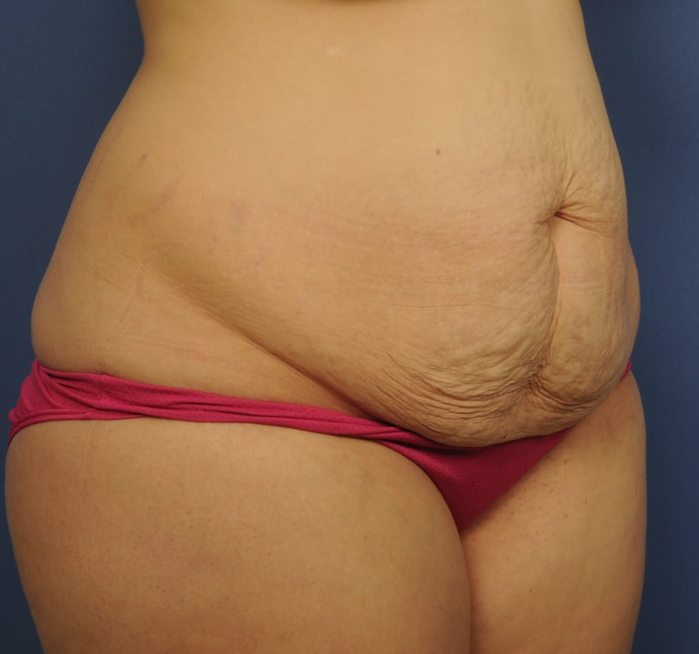 Patient 65 gallery before c