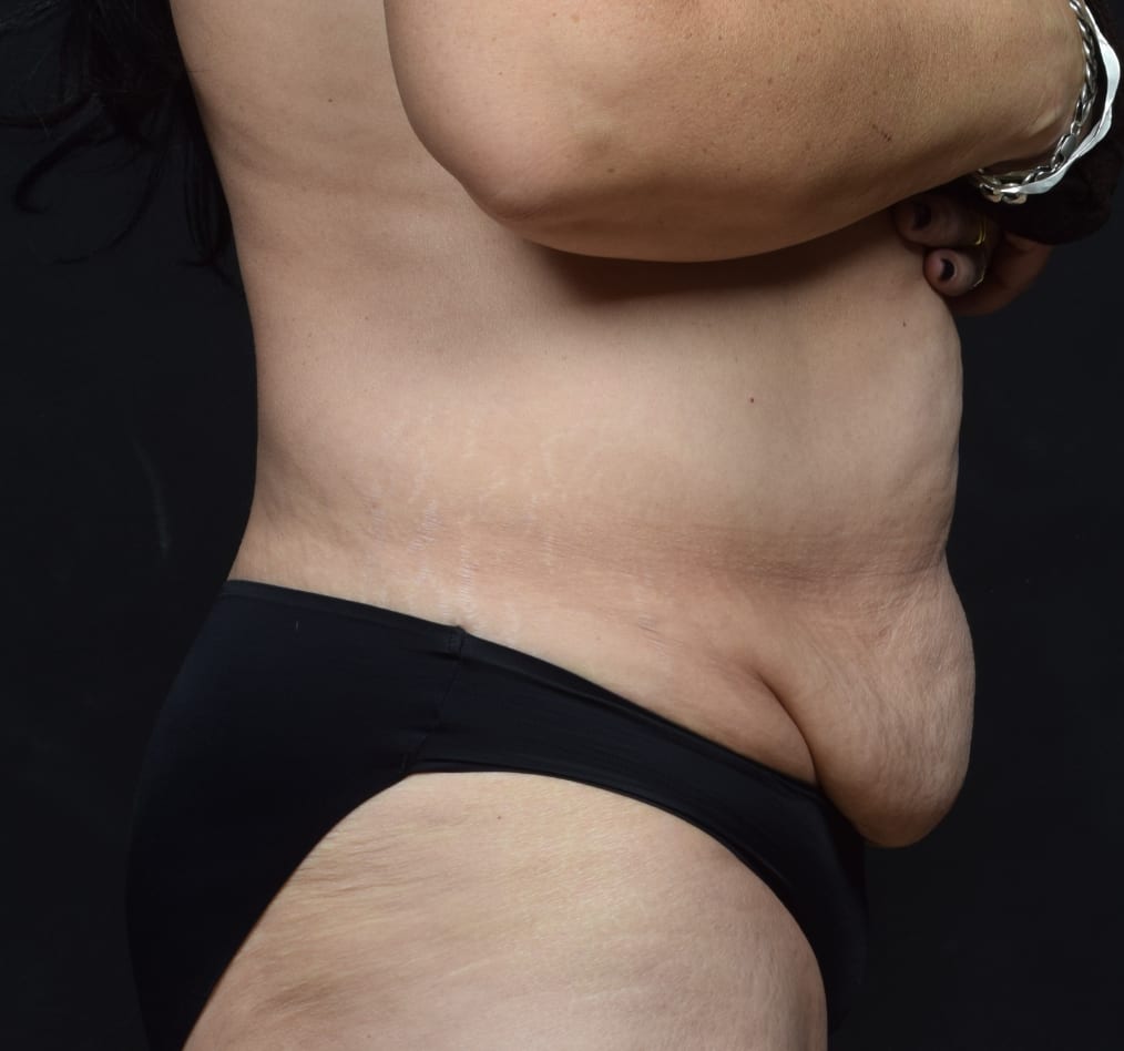 Patient 66 gallery before e