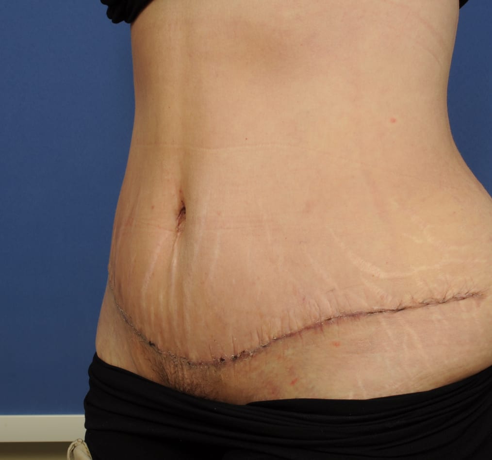 Patient 67 gallery after b