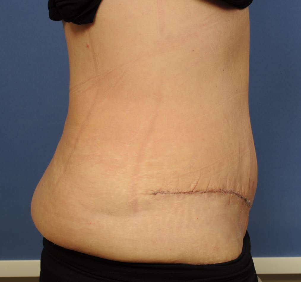 Patient 67 gallery after e