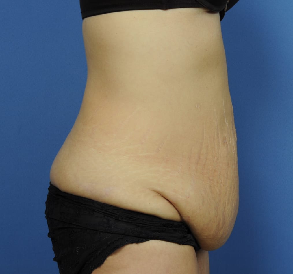 Patient 67 gallery before e