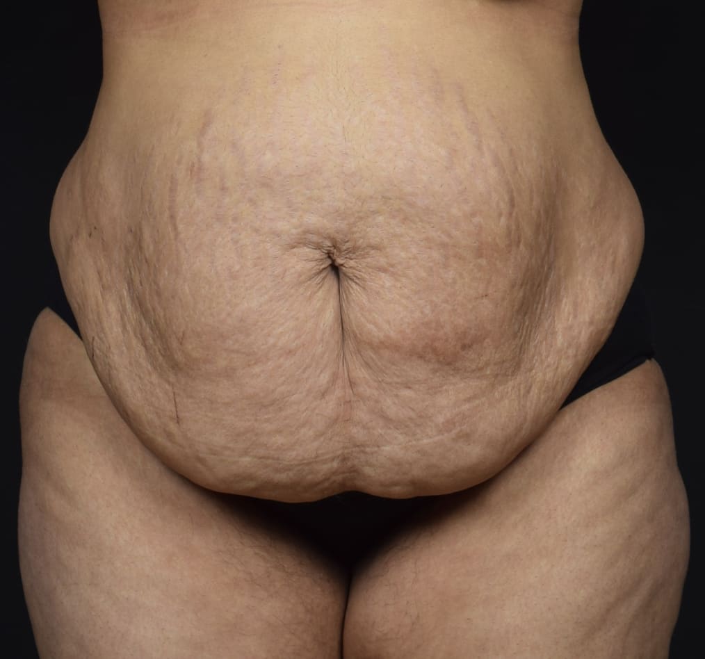 Patient 68 gallery before a