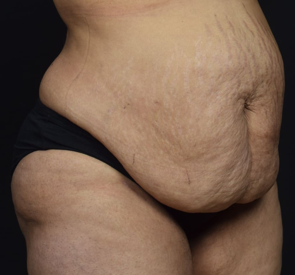 Patient 68 gallery before c