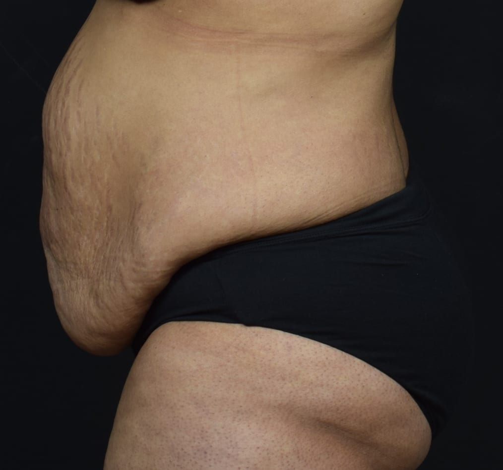 Patient 68 gallery before d