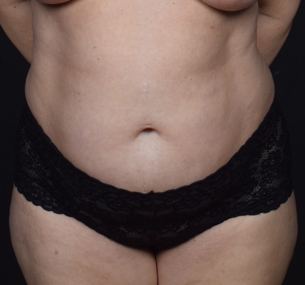 Patient 69 gallery before a