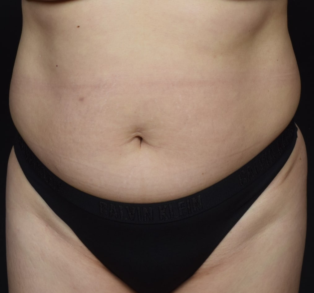 Patient 71 gallery before a