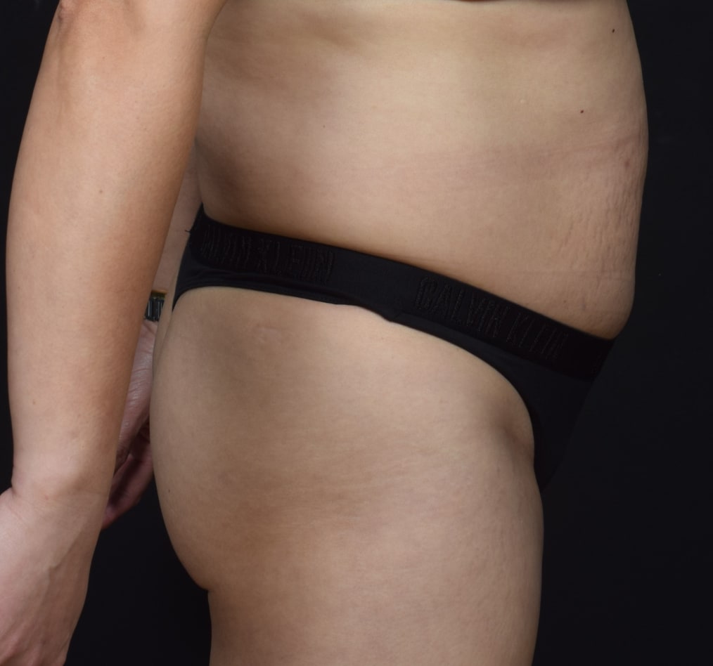 Patient 71 gallery before e