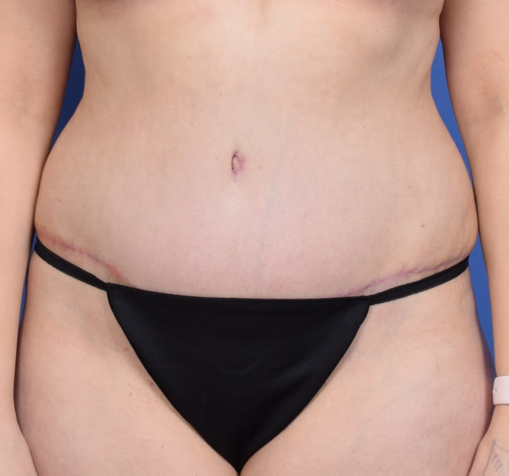 Patient 73 gallery after a