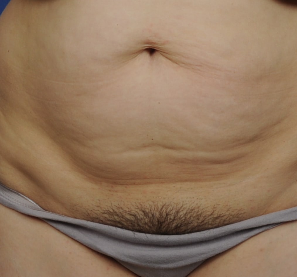 Patient 73 gallery before a