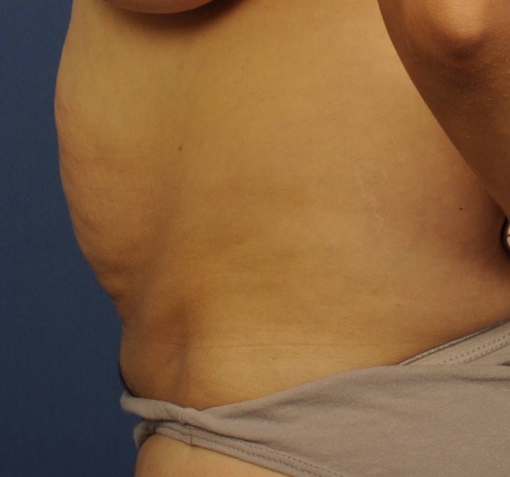 Patient 73 gallery before d