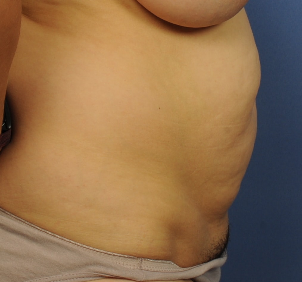 Patient 73 gallery before e