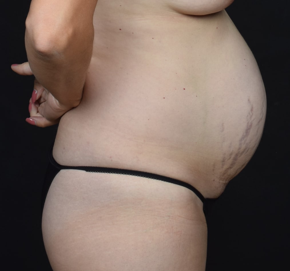 Patient 76 gallery before e