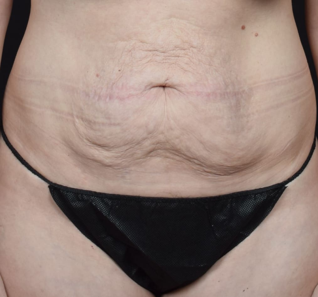 Patient 78 gallery before a