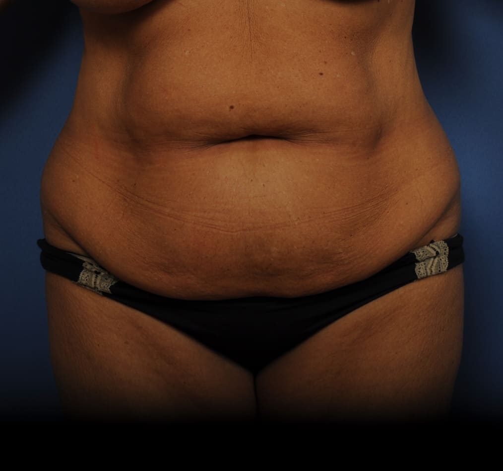 Patient 79 gallery before a