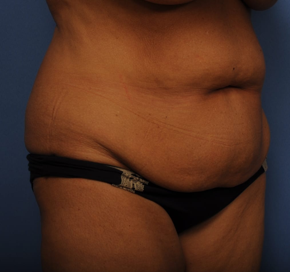 Patient 79 gallery before c