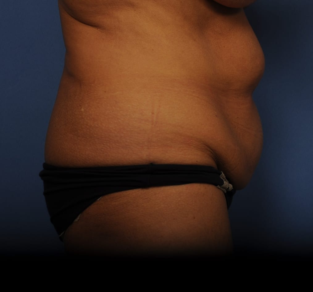 Patient 79 gallery before e