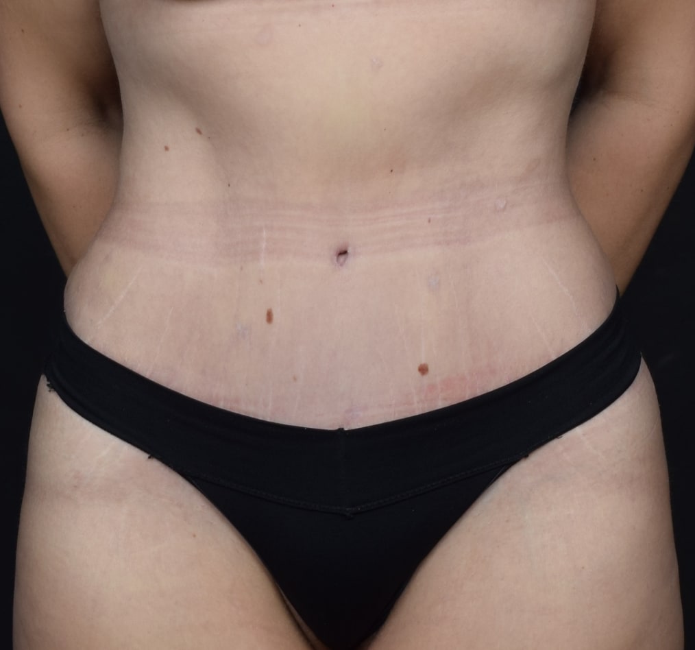 Patient 123 gallery after a