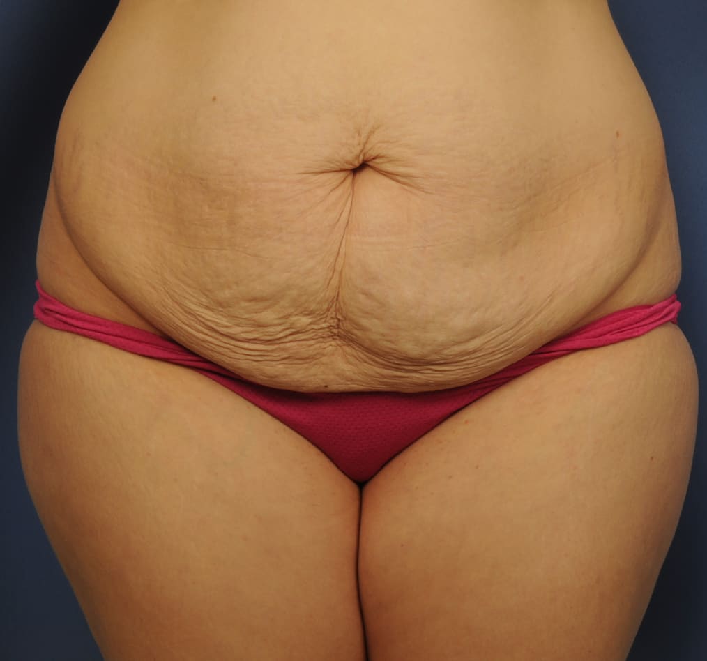 Patient 65 gallery before a