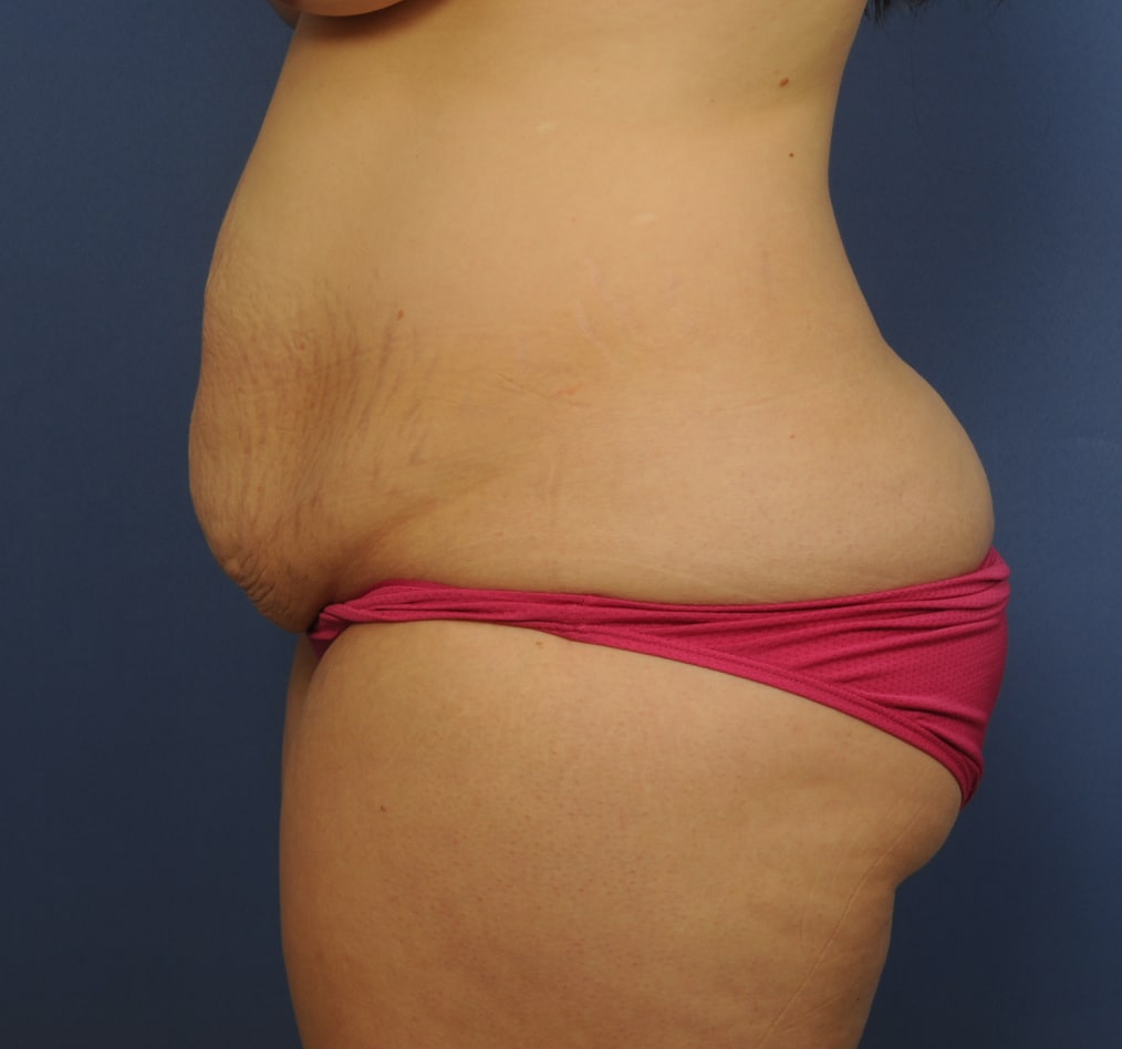 Patient 65 gallery before d