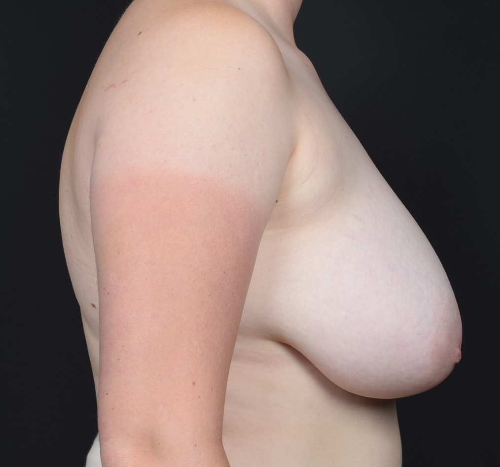 Patient 38 gallery before e