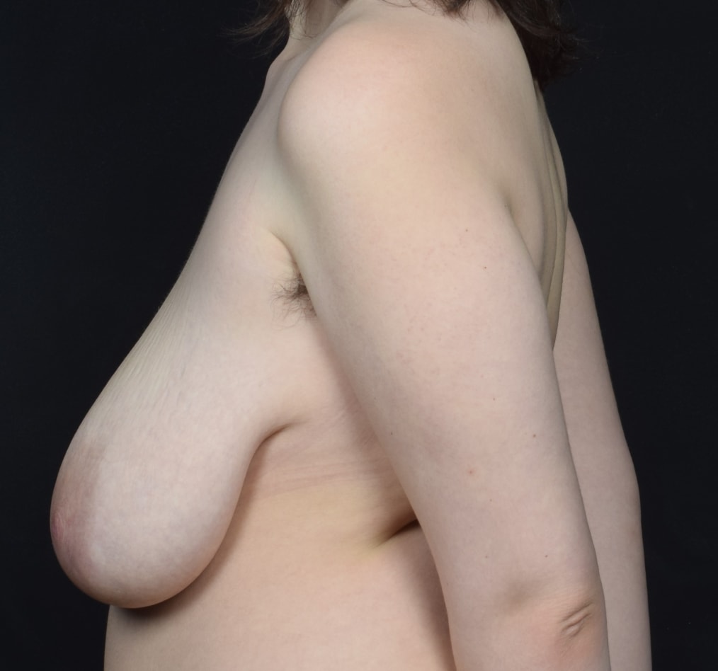 Patient 53 gallery before d