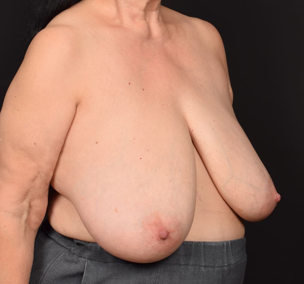 Patient 100 gallery before c