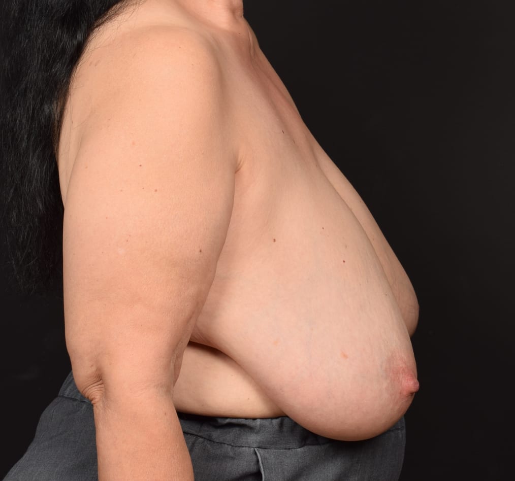 Patient 100 gallery before e