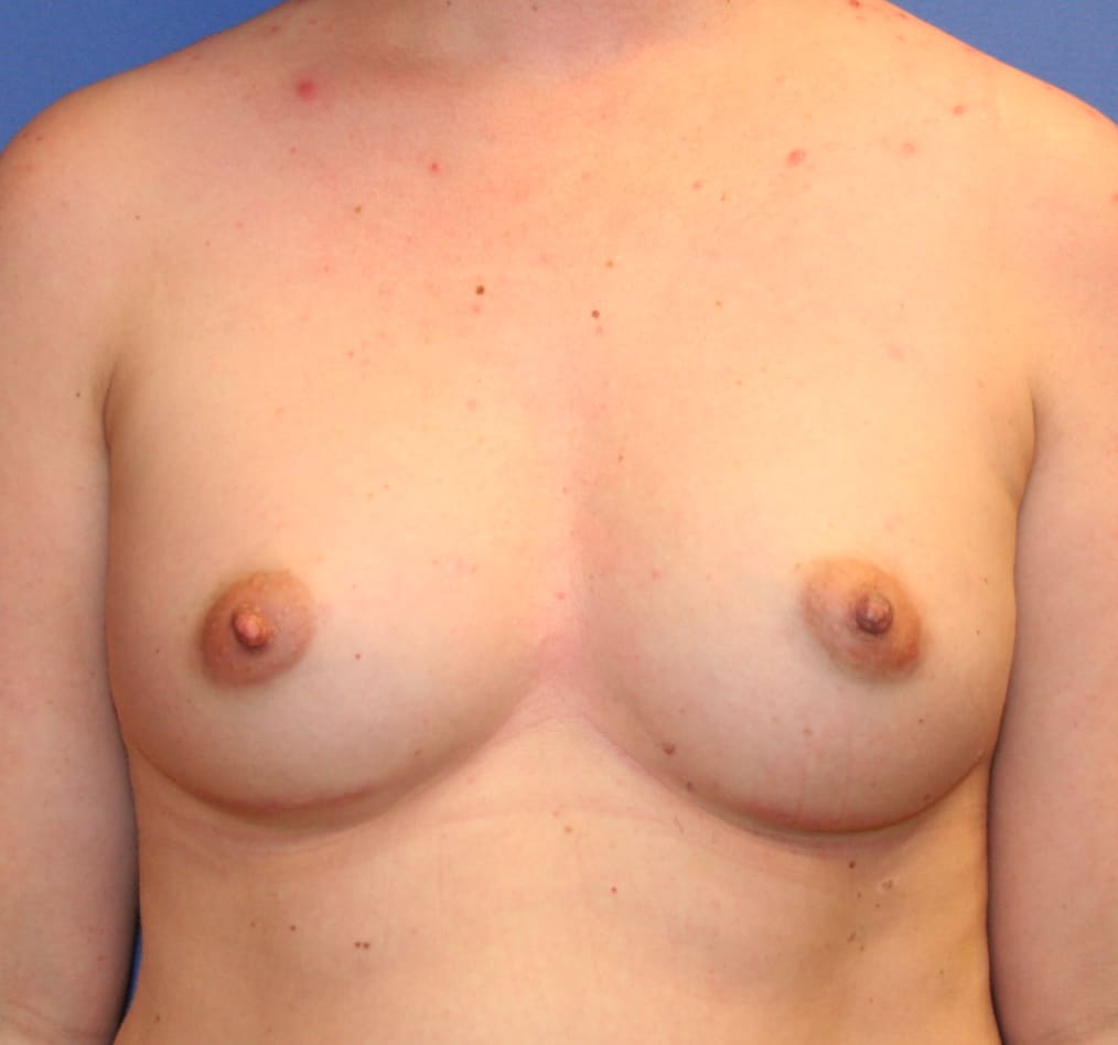 Patient 101 gallery after a