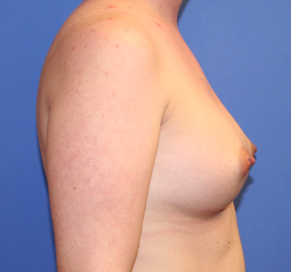 Patient 101 gallery after e