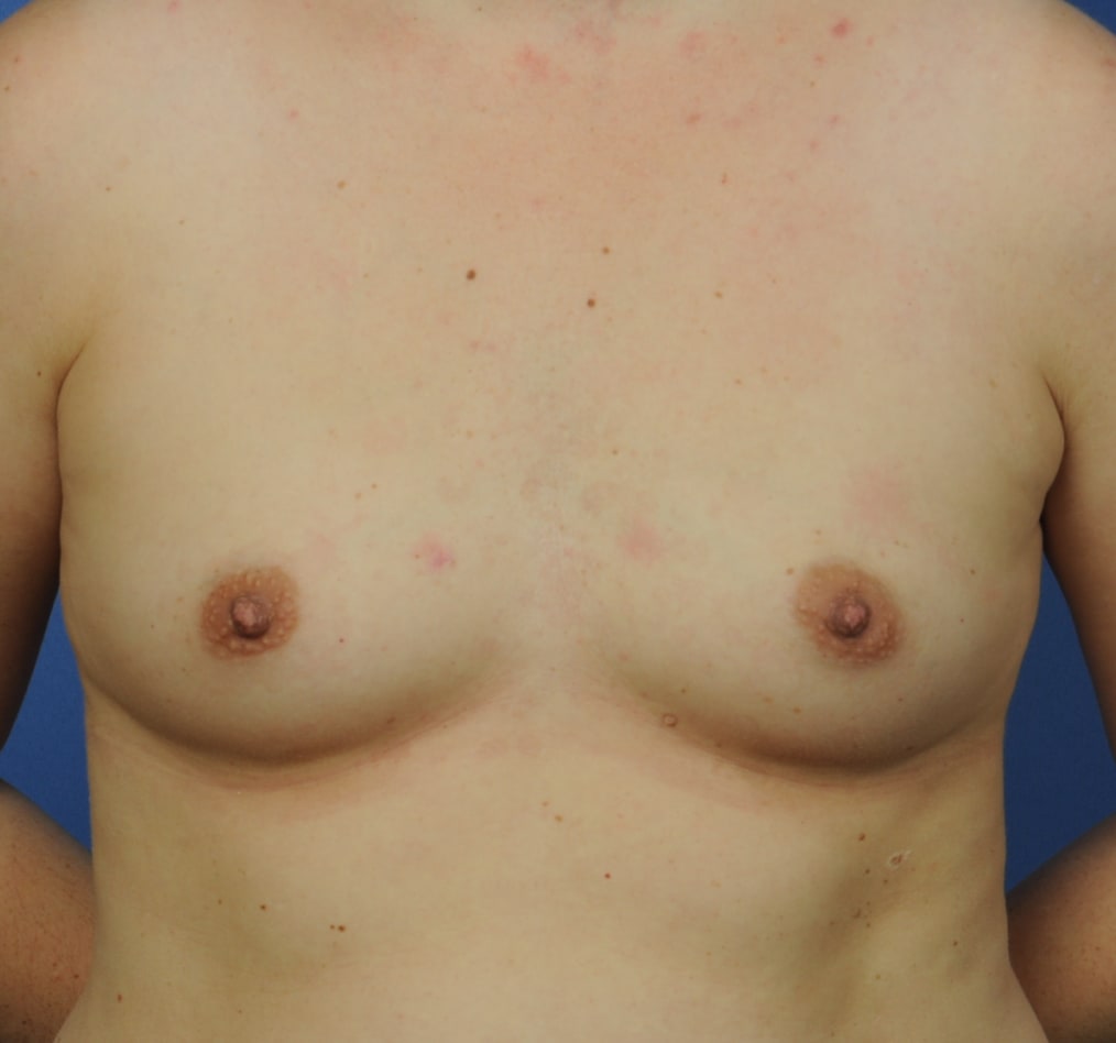 Patient 101 gallery before a