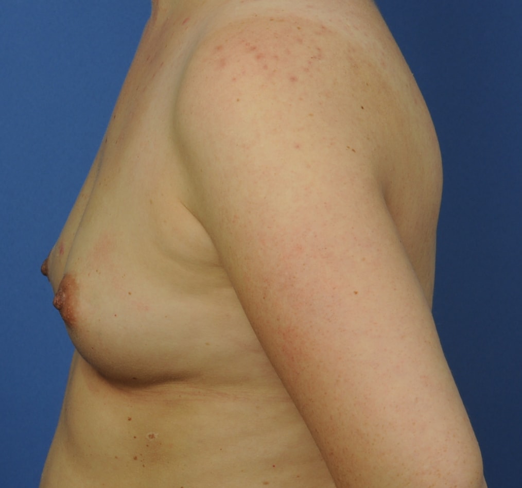 Patient 101 gallery before d