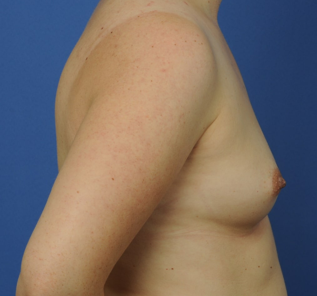 Patient 101 gallery before e