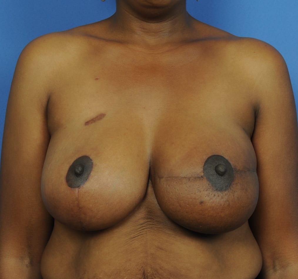 Patient 102 gallery after a