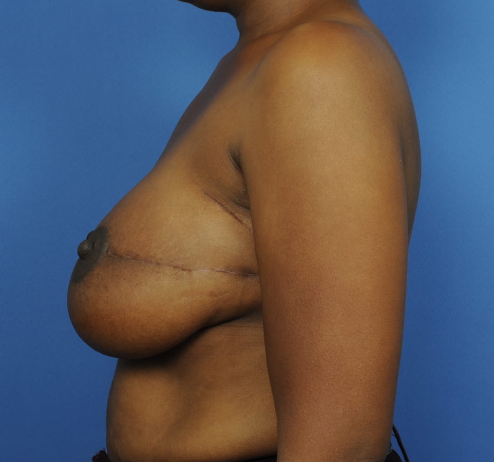 Patient 102 gallery after d