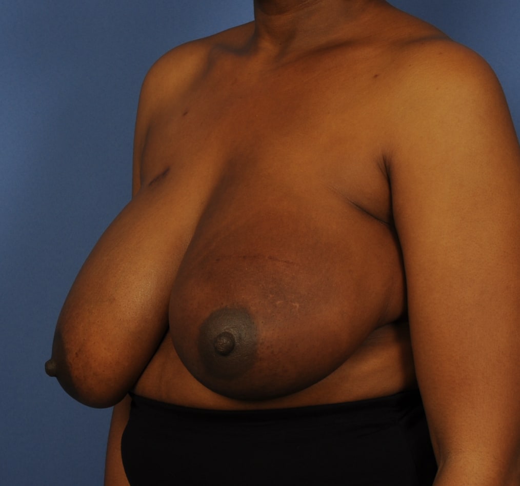 Patient 102 gallery before b