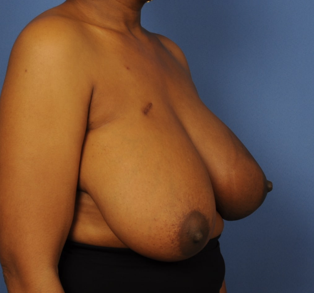 Patient 102 gallery before c